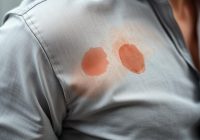 Jak radzić sobie z nadpotliwością pod pachami: przyczyny i metody