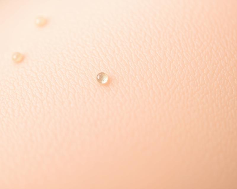 Mezoterapia mikroigłowa – skuteczny zabieg na zmarszczki i blizny