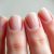Pofałdowane paznokcie – przyczyny, objawy i leczenie problemu zdrowotnego