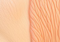 Glikacja skóry: zastosowanie, efekty i przeciwwskazania w praktyce