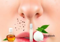 Wągry na nosie: najważniejsze zasady i szybkie wskazówki