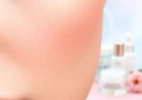 Zaskórniki zamknięte: co pogarsza problem i jak dobrać pielęgnację