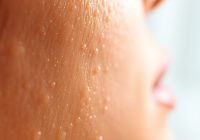 Niacynamid: jak działa, dla kogo jest i jak to bezpiecznie stosować Niacynamid: jak działa, dla kogo jest i jak to bezpiecznie stosować